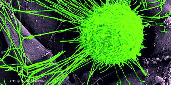 COVID-19 und Krebs: „Krebspatient:innen sind sehr vulnerabel“