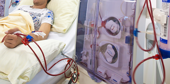 Computermodell soll die Therapie diabetischer Nierenerkrankungen optimieren