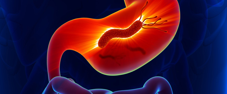 Neue Erkenntnisse zur Therapie des Helicobacter-Keims und der Mikrobiota werden in Innsbruck präsentiert