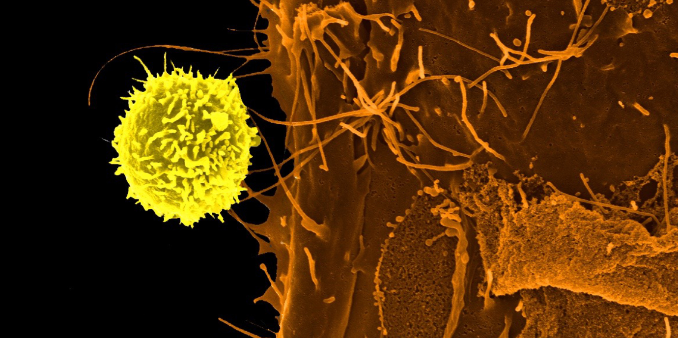 Heiße Doppelspitze gegen kalte Tumoren