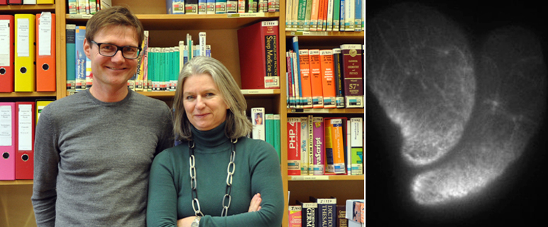 Schon einfacher mechanischer Druck lässt Zellen wandern