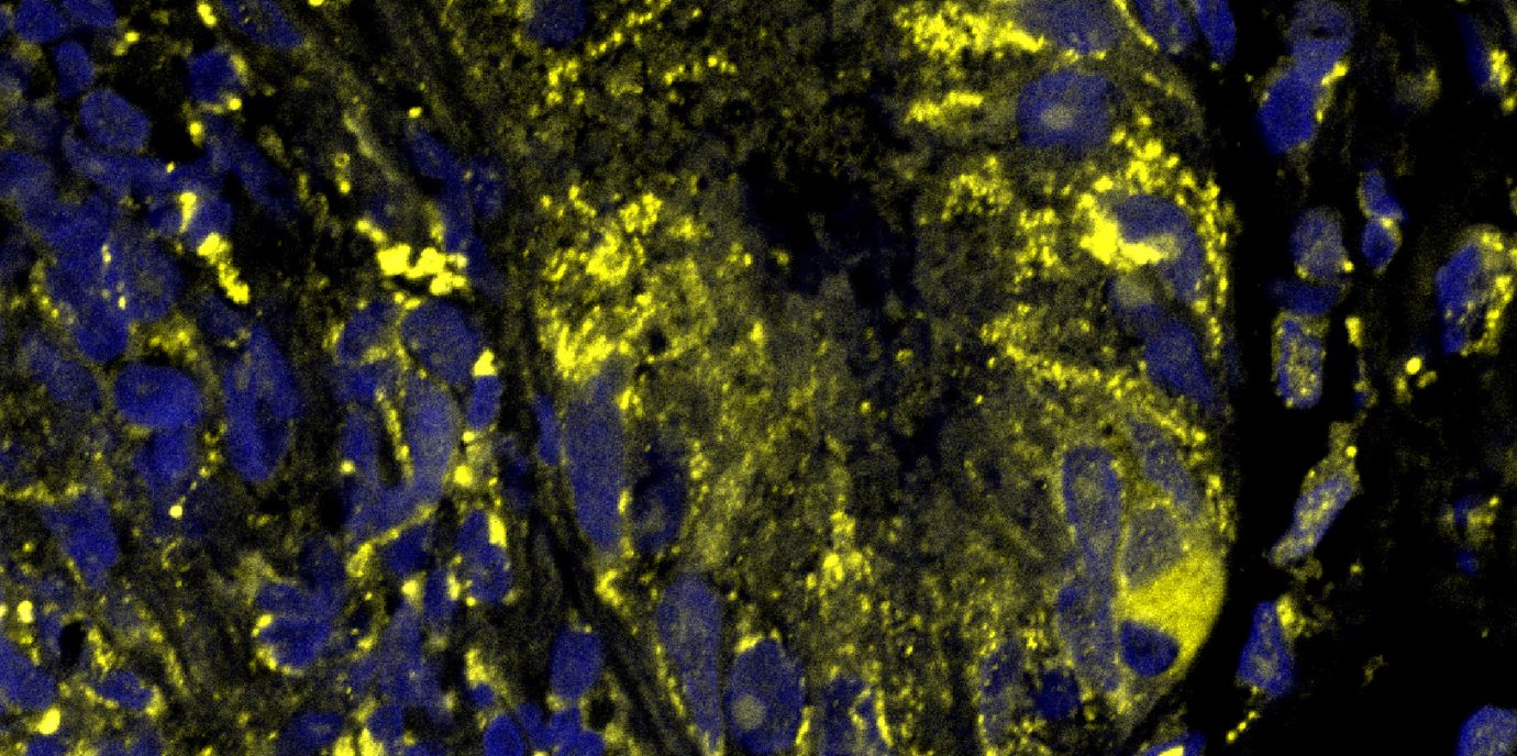 Gesucht, gefunden: Der Rezeptor, der mehrfach ungesättigte Fettsäuren im Darm erkennt