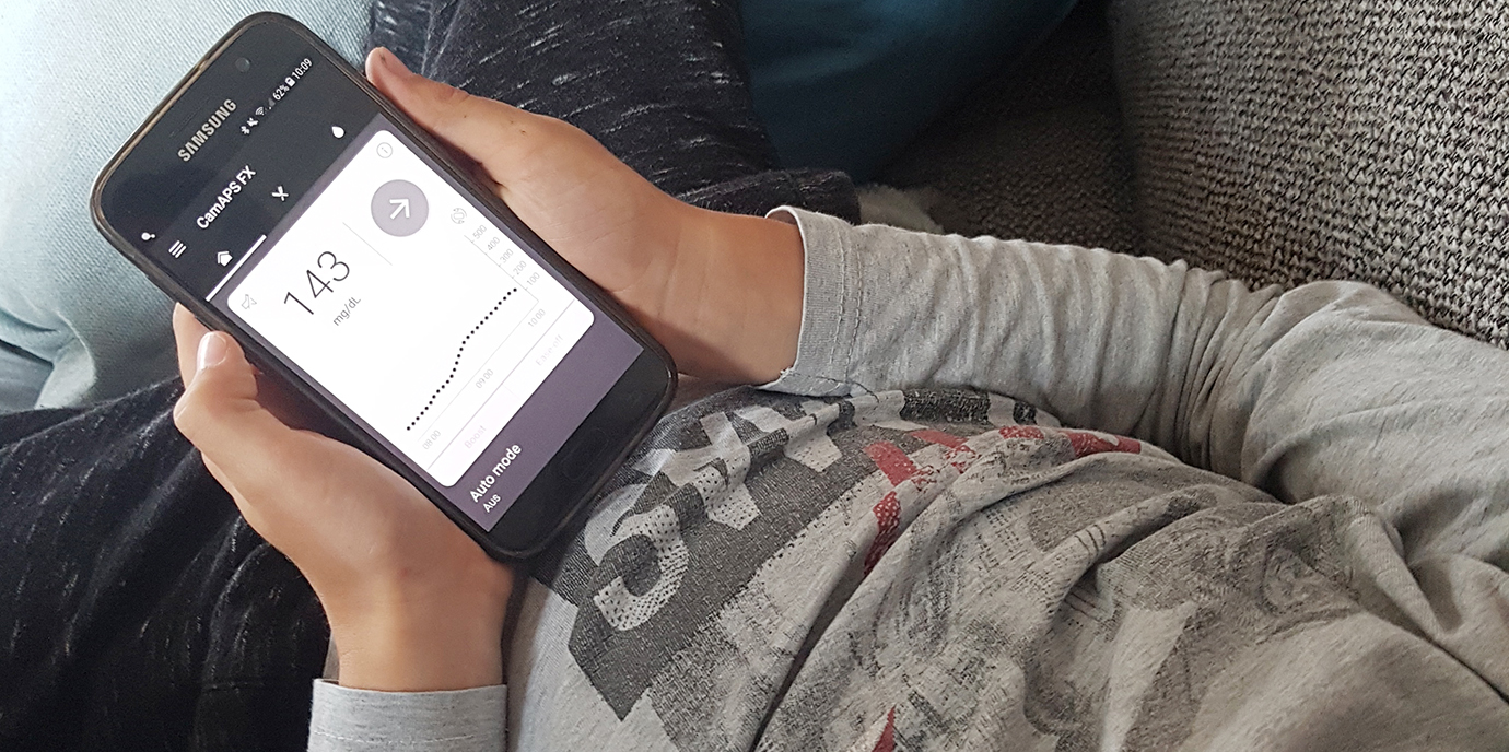 Mit künstlicher Bauchspeicheldrüse zu mehr Lebensqualität