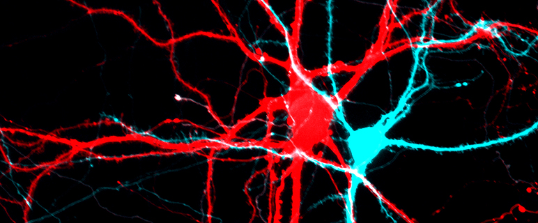 Nervenzellen völlig falsch verbunden