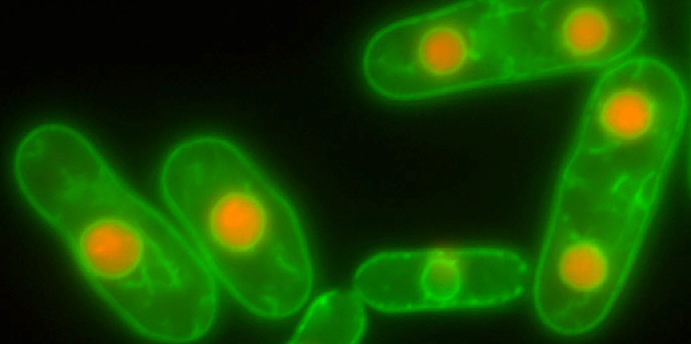 Neue Funktion von ESCRTs im Zellkern entdeckt