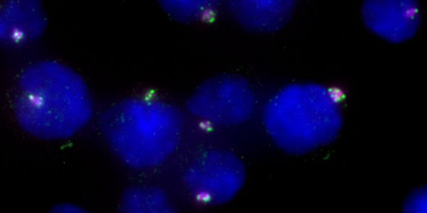 Überraschung: Extra-Zentrosomen können Tumorentstehung bremsen