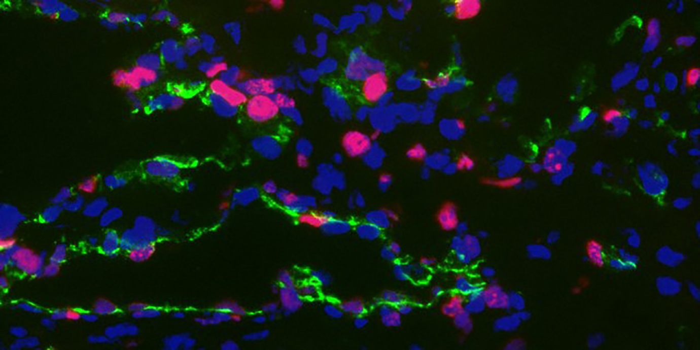 Projekt INCardio: Innovative Therapien zur Behandlung kardiovaskulärer Erkrankungen