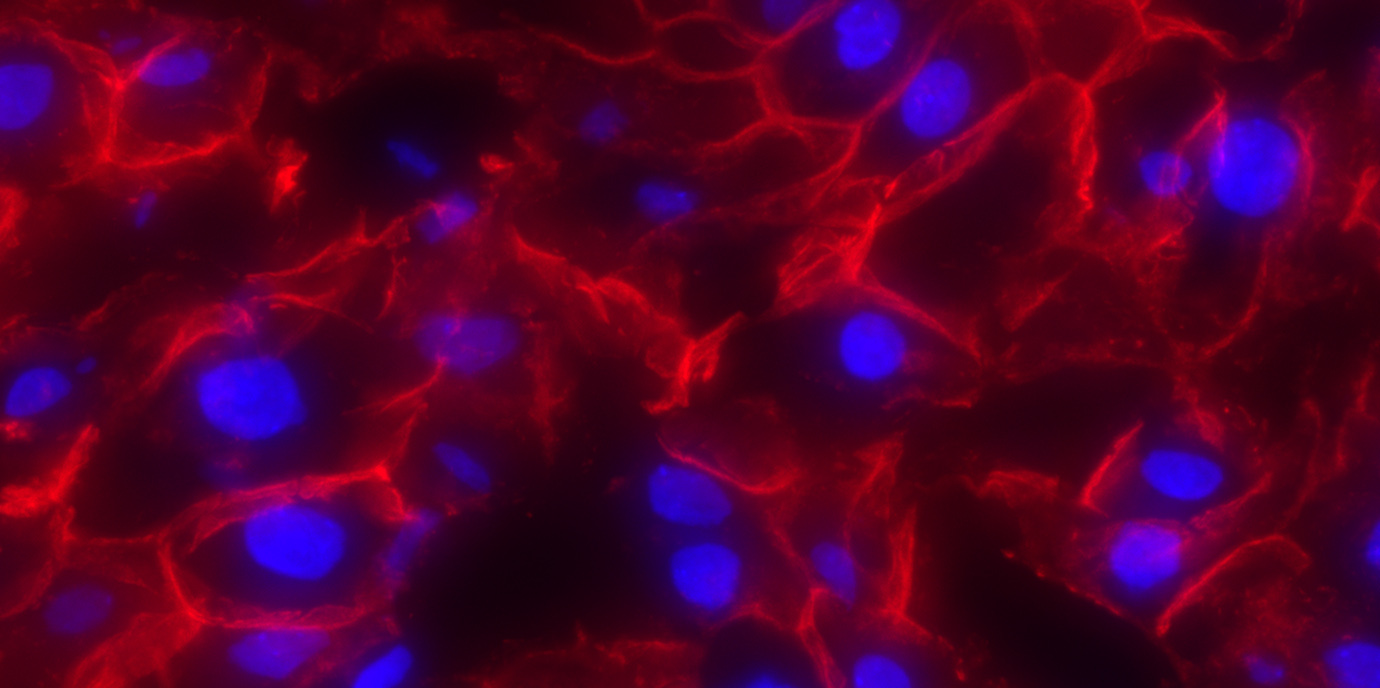 Neues Therapie-Target für die Leberregeneration