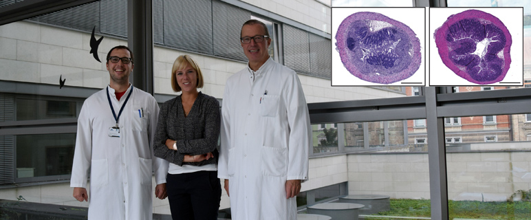 Neues therapeutisches Angriffsziel für akute Colitis 