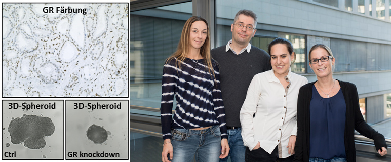 Prostatakrebs: Die Rolle des Glukokortikoid-Rezeptors im Brennpunkt der Therapieforschung