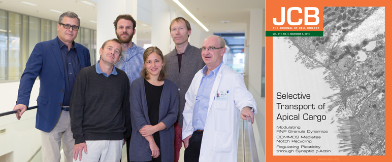 Aufgeklärt: Krankheitsrelevante Mechanismen der lebensbedrohlichen Durchfallerkrankung MVID 