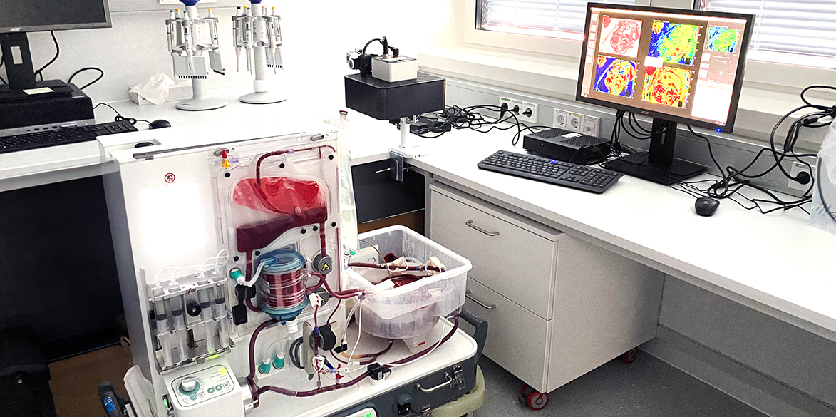 Neuer Hoffnungsträger für Nieren-Transplantationen: Normotherme Maschinenperfusion (NMP)