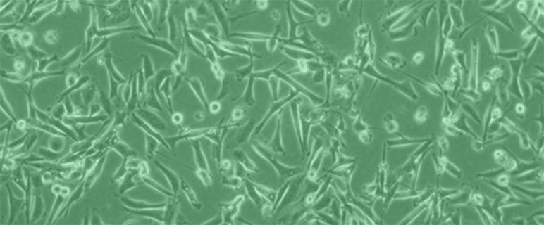 Erstmals nachgewiesen: Direkter Schutz der Niere durch SGLT2 Hemmer