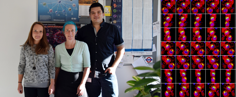 Über  Dendritische Zellen und Komplement zu einer effizienteren Immunantwort