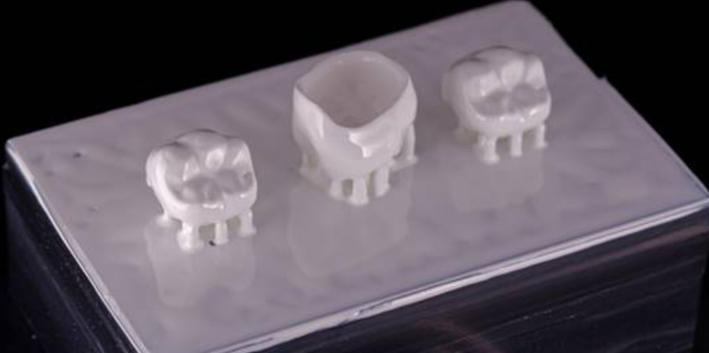 Keramischer Zahnersatz aus dem 3D-Drucker: Neue Erkenntnisse zur Optimierung der Prozesskette