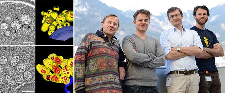 Wie Zellen ihren Sondermüll entsorgen