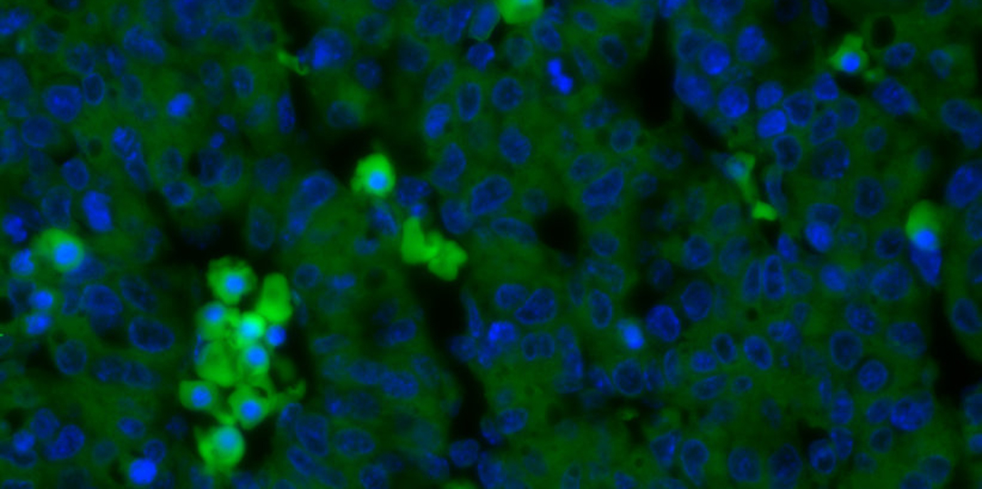 Update: Die Rolle der Kinase CHK1 in früher Blutbildung und B Zell Aktivierung