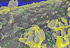 Dendritische Zellen sind essentiell bei der Induktion einer Immunantwort gegen Infektionen und Tumoren. Im Bild eine mit HIV beladene dendritische Zelle (K. Pfaller, D. Wilflingseder).© K.Pfaller THEMA_Day_Immunology.jpg