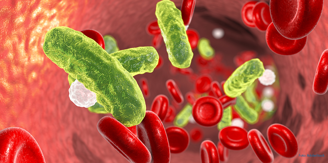 Intensivmedizin: Förderung für Sepsisforschung