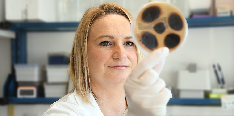 Azol-Resistenzen: Ein Problem für die Therapie von Pilzinfektionen