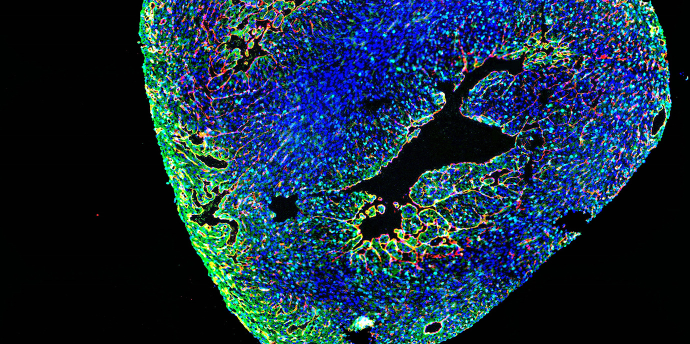 INCardio Jahrestagung: „Gebrochene Herzen heilen“