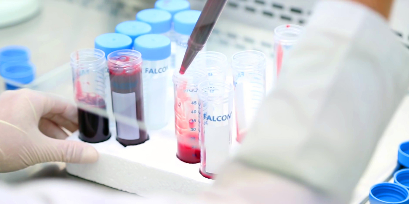 OeNB fördert ein neues klinisches Projekt aus dem Jubiläumsfonds