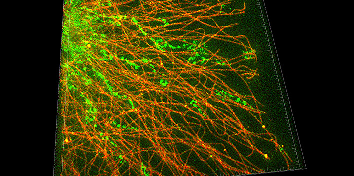 STED: Noch bessere Auflösung und in 3-D